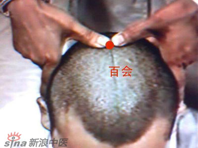 艾灸常用的保健穴有哪些？--百會(huì)